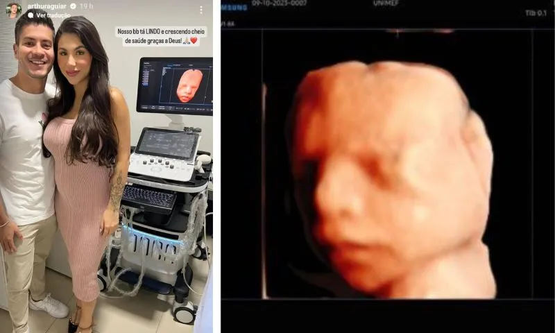 Imagem ilustrativa da imagem Capixaba e Arthur Aguiar mostram ultrassom do bebê pela primeira vez