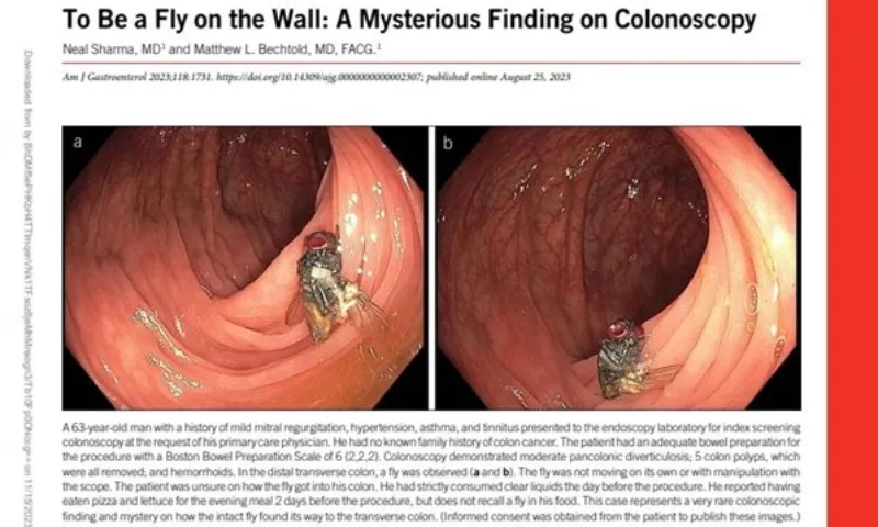 Imagem ilustrativa da imagem Médicos encontram mosca intacta em intestino de idoso nos EUA