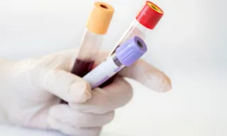Imagem ilustrativa da imagem Exame de sangue para diagnóstico de Alzheimer chega ao Brasil