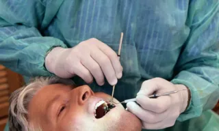 Imagem ilustrativa da imagem Mutirão para diagnóstico de câncer bucal e odontologia geral na quarta-feira