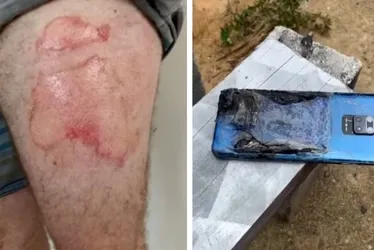 Imagem ilustrativa da imagem "Ainda bem que não estava na minha mão", diz caminhoneiro após celular explodir
