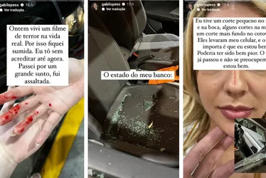 Imagem ilustrativa da imagem Atriz Gabi Lopes é assaltada dentro do carro e mostra ferimentos