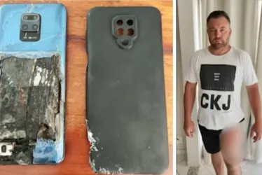 Imagem ilustrativa da imagem Celular explode e provoca queimaduras na perna de caminhoneiro no ES
