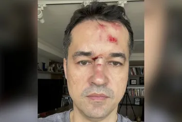 Imagem ilustrativa da imagem Deltan da Lava Jato cai da bicicleta e vira alvo de xingamentos nas rede