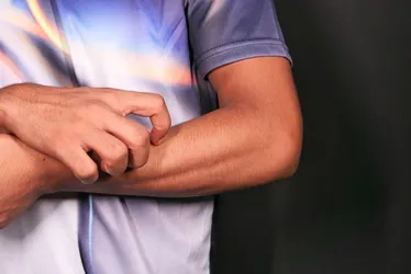 Imagem ilustrativa da imagem ES já tem 578 casos de doença provocada pelo fungo esporotricose