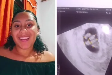 Imagem ilustrativa da imagem Jovem descobre que está grávida de quíntuplos e chega a passar mal em ultrassom