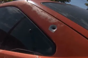 Imagem ilustrativa da imagem Jovem é baleado na cabeça após tentativa de assalto na Serra