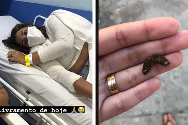 Imagem ilustrativa da imagem Mulher é arremessada de brinquedo no Parque Mirabilândia e sofre traumatismo