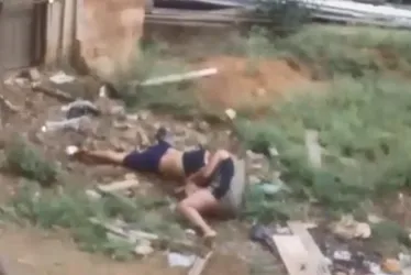 Imagem ilustrativa da imagem Mulher tem parte da orelha arrancada durante briga no ES
