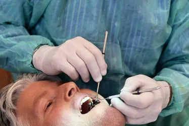 Imagem ilustrativa da imagem Mutirão para diagnóstico de câncer bucal e odontologia geral na quarta-feira