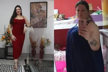 Imagem ilustrativa da imagem Pacientes mostram “antes e depois” após cirurgias e procedimentos estéticos