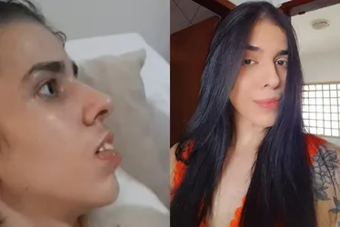 Imagem ilustrativa da imagem VÍDEO | Jovem que cheirou pimenta tem melhora