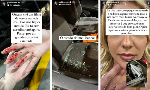 
          Imagem ilustrativa da imagem Atriz Gabi Lopes é assaltada dentro do carro e mostra ferimentos
          