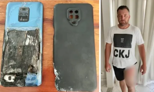 
          Imagem ilustrativa da imagem Celular explode e provoca queimaduras na perna de caminhoneiro no ES
          