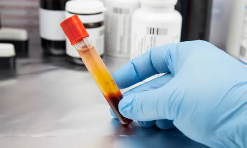 
          Imagem ilustrativa da imagem Comissão do Senado aprova PEC que libera venda do plasma humano
          