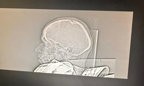 
          Imagem ilustrativa da imagem Crea reprova 30 postes em Vila Velha
          