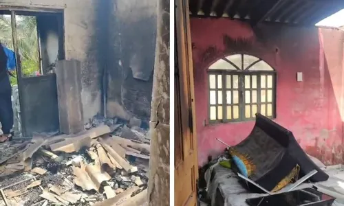 
          Imagem ilustrativa da imagem Criança de 8 anos é entubada após grávida colocar fogo em casa
          