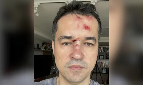 
          Imagem ilustrativa da imagem Deltan da Lava Jato cai da bicicleta e vira alvo de xingamentos nas rede
          