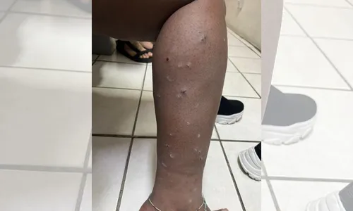 
          Imagem ilustrativa da imagem Deputada do RS é agredida com spray de pimenta pela Guarda Municipal
          