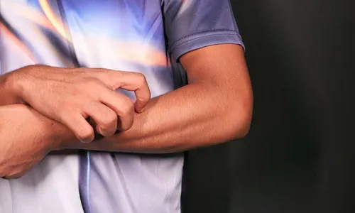 
          Imagem ilustrativa da imagem ES já tem 578 casos de doença provocada pelo fungo esporotricose
          