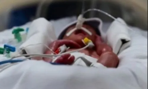 
          Imagem ilustrativa da imagem Estado de saúde de Theo piora: "Cremos em um milagre", diz pai dos sêxtuplos do ES
          