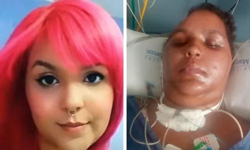 
          Imagem ilustrativa da imagem Família de professora Davine, que caiu de brinquedo no Mirabilândia, faz vaquinha
          