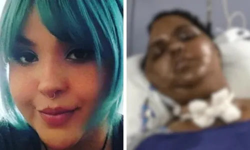 
          Imagem ilustrativa da imagem Família de professora Davine, que caiu de brinquedo no Mirabilândia, faz vaquinha
          