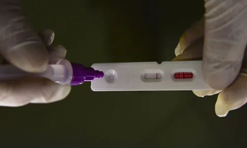 
          Imagem ilustrativa da imagem Internações por Covid em São Paulo aumentam 35%
          