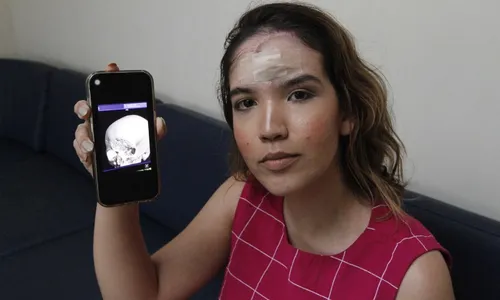 
          Imagem ilustrativa da imagem “Já perdoei, mas quero justiça”, diz advogada ferida com pedrada
          