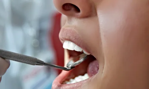 
          Imagem ilustrativa da imagem Linhares realiza ação de combate ao câncer de boca nesta sexta-feira
          