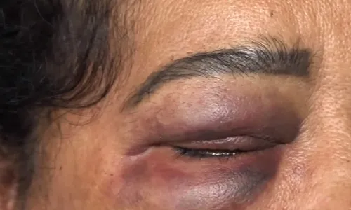 
          Imagem ilustrativa da imagem Manicure é agredida pelo ex-marido após se recusar a cozinhar
          