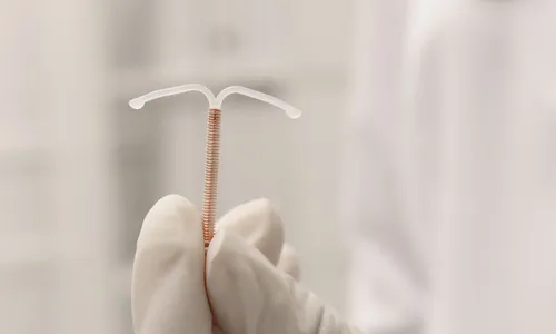 
          Imagem ilustrativa da imagem Medo de pôr DIU e se arrepender
          