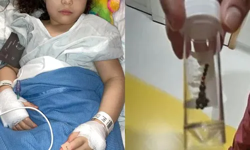 
          Imagem ilustrativa da imagem Menina perde parte do intestino após engolir bolas magnéticas na Inglaterra
          