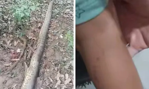 
          Imagem ilustrativa da imagem Menino de 2 anos é atacado por sucuri de 6 metros
          