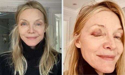 
          Imagem ilustrativa da imagem Michelle Pfeiffer aparece com olho roxo; entenda
          