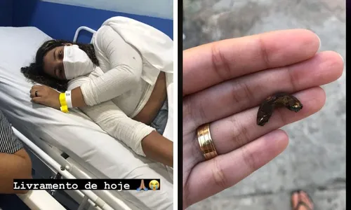 
          Imagem ilustrativa da imagem Mulher é arremessada de brinquedo no Parque Mirabilândia e sofre traumatismo
          