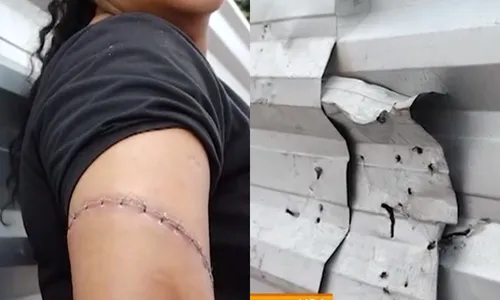 
          Imagem ilustrativa da imagem Mulher é atingida por proteção de obra e fica ferida na Serra
          