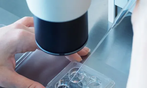 
          Imagem ilustrativa da imagem Mulher processa médico por usar o próprio esperma em inseminação
          