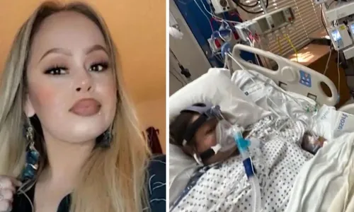 
          Imagem ilustrativa da imagem Mulher tem braços e pernas amputados de uma vez após comer tilápia
          