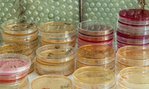 
          Imagem ilustrativa da imagem OMS alerta para aumento de casos de cólera no mundo
          