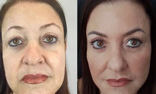 
          Imagem ilustrativa da imagem Opção por cirurgias ou procedimentos estéticos por influência das redes sociais
          