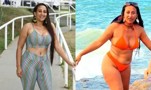 
          Imagem ilustrativa da imagem Pacientes mostram “antes e depois” após cirurgias e procedimentos estéticos
          