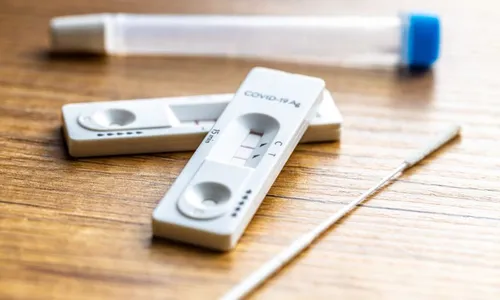 
          Imagem ilustrativa da imagem SUS terá novo teste rápido duplo para HIV e sífilis em gestantes
          