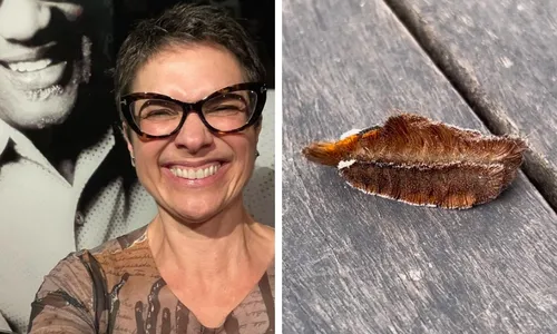 
          Imagem ilustrativa da imagem Sandra Annenberg publica foto no hospital após pisar em lagarta: 'Dor insuportável'
          