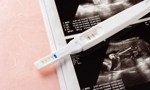 
          Imagem ilustrativa da imagem Seis em cada 10 mulheres já tiveram uma gravidez não planejada
          