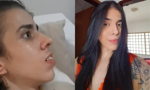 
          Imagem ilustrativa da imagem VÍDEO | Jovem que cheirou pimenta tem melhora
          