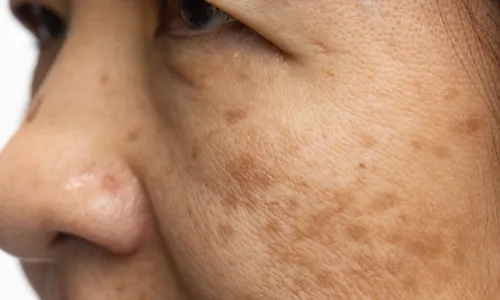 
          Imagem ilustrativa da imagem Veja quais são os cinco alimentos que mais envelhecem a pele
          