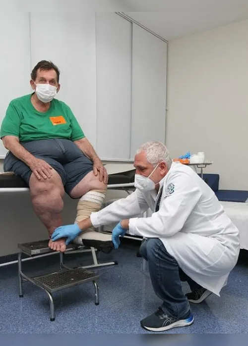 Imagem ilustrativa da imagem Espírito Santo tem queda em amputações por diabetes