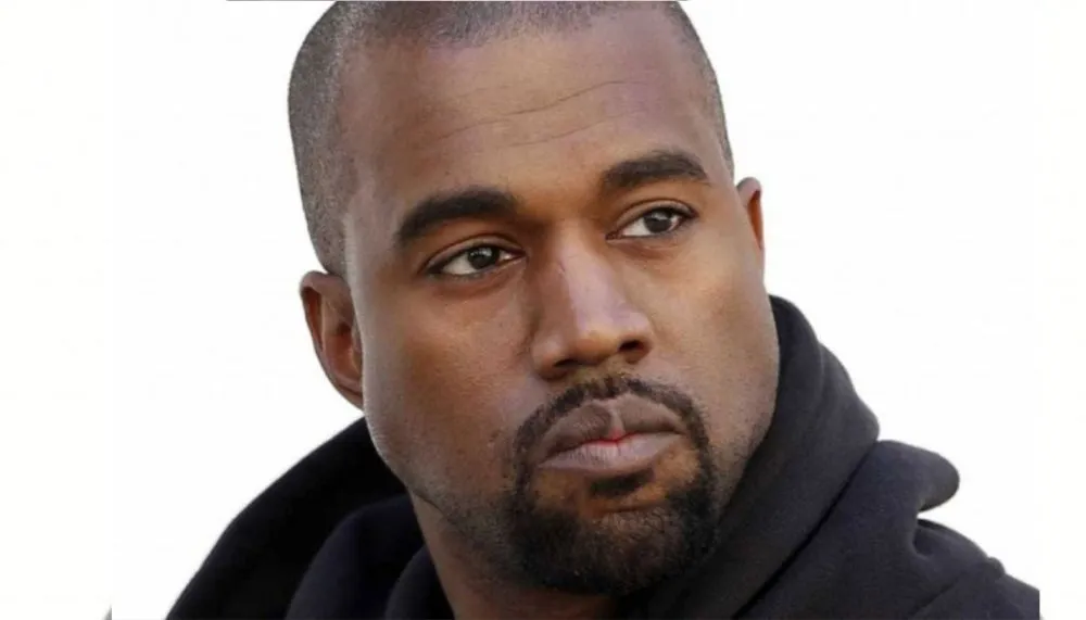 Imagem ilustrativa da imagem Kanye West coloca prótese de titânio de R$ 4 milhões nos dentes