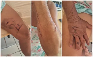 Imagem ilustrativa da imagem Agricultora é atacada por onça no Sertão de Pernambuco